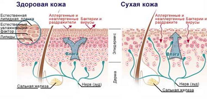 здоровая кожа - сухая кожа